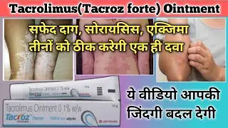 tacrolimus ointment 0.1 w/w review | tacrolimus ointment | tacroz forte 0.1 ointment | tacroz forte