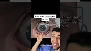 This is How Laser Eye Surgery Works #blurry