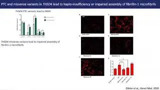 Pathogenic variants in THSD4, encoding the ADAMTS-Like 6 protein, predispose to inherited...