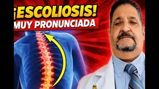 Artrosis de rodilla: &iexcl;Descubre c&oacute;mo recuperar tu movimiento sin dolor!