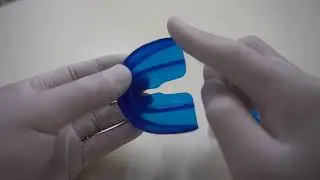 プレオルソX　新しい拡大方法
