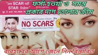 No Scars Cream Review in Bengali ,NO Scar cream results, benefits, uses, price , উপকারিতা,Fairness