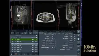How to Plan MRI of the Pelvis | Step-by-Step Guide