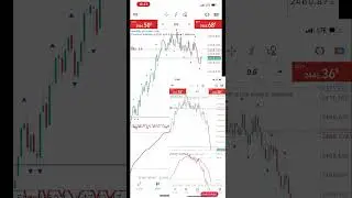 How To Grow Your Small Capita Using This Powerful &ldquo;Volatility 25&rdquo; Strategy as a Beginner #forex