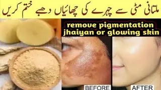 Winter Special Skin Glowing Challenge with Multani Mitti | Multani Mitti Face Pack | Skin Whitening