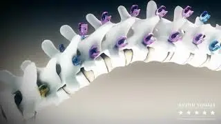 3D Medical Animation Showreel 2025 | Medical 3D Animation Company Showreel #medicalanimations