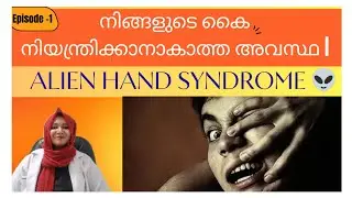 കൈ തനിയെ ചലിക്കുന്നു?Strange Medical Condition &ndash; Episode 1 | Alien Hand Syndrome 😱