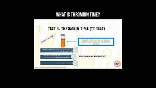 What is thrombin time? #test #thrombin