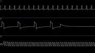 tennisers - mom turn the classical radio off i want to listen to slipknot [Gameboy] (oscilloscope)