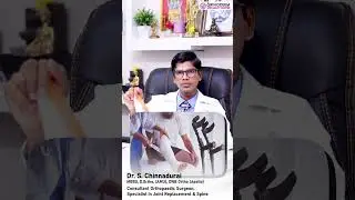 Fast Knee Pain Relief - Complete&nbsp;Guide #shorts #trending #kneepain #painrelief #kneepainrelief