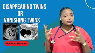 VANISHING TWINS SYNDROME: What happens and what can be done?