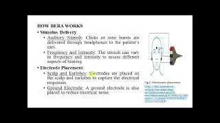 Lab_Exp5: BERA