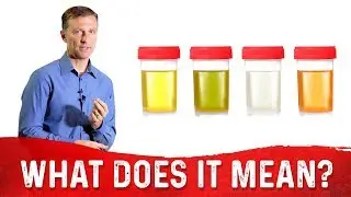 What Does The Color Of Urine Tell You About Your Body? &ndash; Dr.Berg