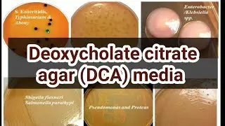 Deoxycholate Citrate agar (DCA) media: culture media lecture 33