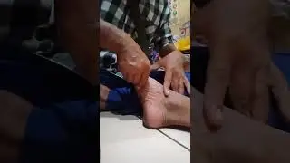 terkilir atau keseleo...cukup diurut saja sampe  otot otot sekitarnya lemas