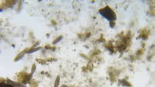 Paramecium and a stentor. No audio.