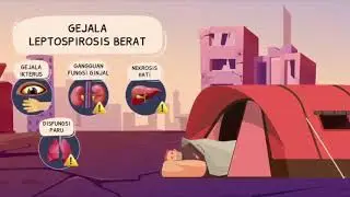 WASPADA LEPTOSPIROSIS SD 852X480