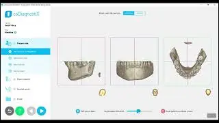 How To Segment DICOM Codiagnostix EASY