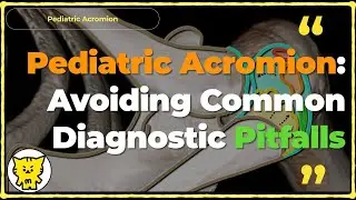 📌Pediatric Acromion: Avoiding Common Diagnostic Pitfalls
