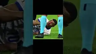 Mbapp&eacute; nez cass&eacute; 🇫🇷 masque 🇫🇷 #football