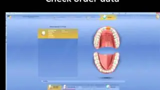 Dental Crafts Master: How to Use Sirona Connect Portal