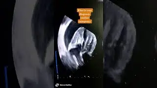 #vet #medical #veterinarian #cardiology #criticalthinking #echocardiography #diamondpetclinic