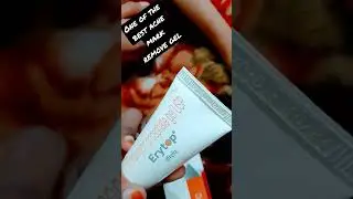 acne best removal gel#erytop