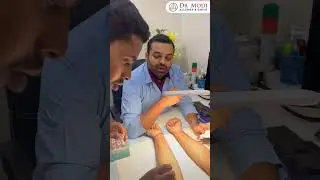 How Accurate is Skin Prick Test Allergy Test?