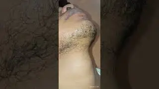 minoxidil 5% beard growth oil 21days journey result please subscribe my channel