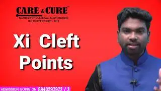 xi cleft points: Acupuncture time:Tcm in tamilnadu