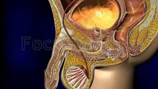 Urodynamic assessment - Animated Atlas of BPH and OAB