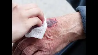 Trailer Verletzungen - H&ouml;henkrankheit - Op Folgen - Dr Peter Blaimschein