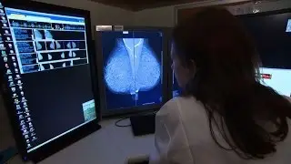 Double mastectomy may not be necessary in breast cancer patients, study finds