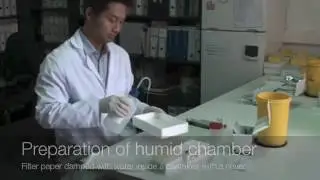 Pneumoslide IgM Demo by VirCell, Spain