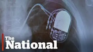 Health Canada reviewing fix to protect pacemakers from hackers