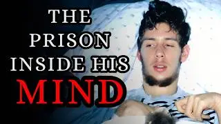 The Most Horrifying Medical Case: Conscious But Completely Paralyzed