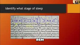 Sleep Study Results Decoded: Central Apnea & REM Sleep Explained