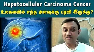 Hepatocellular Carcinoma Cancer என்றால் என்ன? | Checkup | Cancer | Health | Kalaignar News