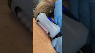 EndoBody Pro AMG 1100