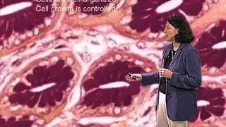 Cancer Development - Mary Beckerle (Utah)