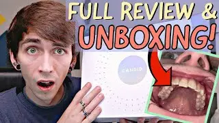 CANDID Co. Aligners UNBOXING & Review!