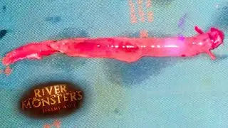 Removing A Candiru From Man's Penis | HORROR STORY | River Monsters