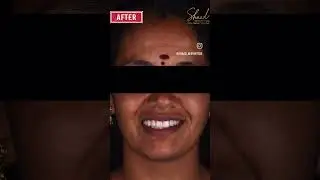 Best dental clinic in Coimbatore|Best dentist|Dental clinic in Coimbatore|Shaad Aesthetics|Dr Arshad