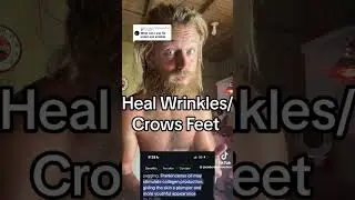 How to Heal Wrinkles & Crows Feet