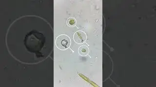 Microorganisms Under Microscope [Part 1] | Learn Practically #euglena #paramecium #science