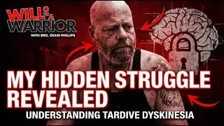 Understanding Tardive Dyskinesia