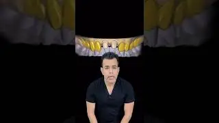 Digital Dentistry India #delhidentist #bestdentistdelhi