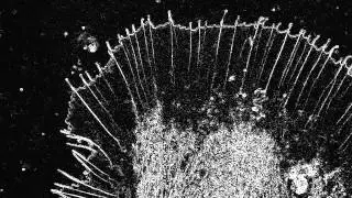 Growth Cone of Aplysia Bag Cell Neuron