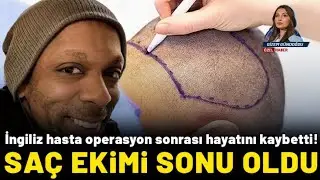 SA&Ccedil; EKİMİ SONRASI &Ouml;L&Uuml;M || MARTYN JAMES LATCHMAN