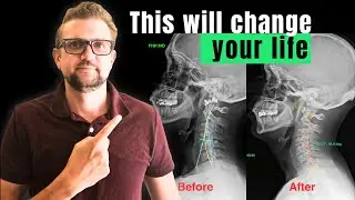 15 years of chiropractic in 18 minutes| Full X-Ray Guide | Dr Randy CRACKS